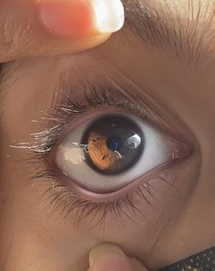 a person holding their hand up to the eye of another persons eye with an insect on it