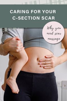 CARING FOR YOUR C-SECTION SCAR: TIPS AND INSIGHTS FOR A SMOOTH RECOVERY | UNDEFINING MOTHERHOOD | Calling all new moms concerned about C-Section recovery! Dive into this essential guide where we highlight the incredible advantages of scar massage and the role of silicone tape in preventing infections and ensuring a smooth healing process. Want to bid farewell to concerns about potential complications and confidently navigate your post-C-Section journey? Click here! Scar Massage, C Section Scar, C Section Scars, Silicone Tape, All About Pregnancy, Pregnancy Announcement Ideas, Mommy Tips, Take Care Of Your Body