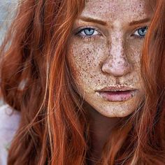 Woman With Freckles, Red Hair Freckles, Women With Freckles, Beautiful Freckles, Fair Complexion, Freckles Girl, Freckle Face, Red Hair Woman