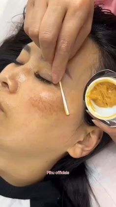 Dark Spot Remover, How To Get Rid Of Pigmentation On Face, Dark Pigmentation On Face, Home Remedies For Dark Spots, Dark Spots On Body How To Remove, How To Remove Pigmentation, How To Remove Dark Spots On Face At Home, How To Remove Dark Spots On Face, Remedies To Remove Dark Spots On Skin