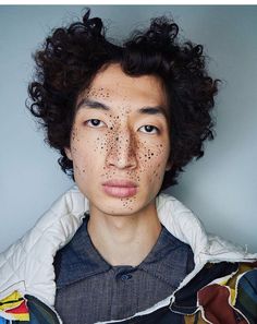 a young man with freckles on his face