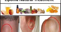 Lipoma Removal, Herbal Therapy, Hair Removal Cream, Oil Uses, Diy Health, Essential Oil Uses, Natural Treatments, Healthy Mind, The Skin