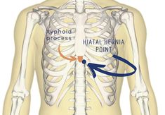 Productive Cough, Referred Pain, Low Stomach Acid, Abdominal Discomfort, Reflux Disease