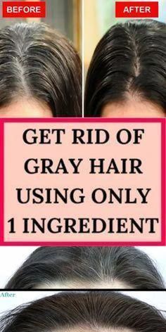 Grey Hair Home Remedies, Stop Grey Hair, Hair Home Remedies, Homemade Medicine, Grey Hair Care, Hair Remedies, Hair Care Tips, Gray Hair