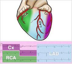 Cardiology Nursing, Cardiac Nurse, Coronary Artery, Family Nurse Practitioner, Cardiac Nursing, Nursing School Survival