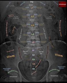 an x - ray shows the different types of bones and their corresponding names on it