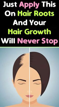 Super Fast Hair Growth, Fast Hair Growth, Extreme Hair Growth, Fast Hair, Hair Roots, Brown Spots On Face, Extreme Hair, Fast Hairstyles, Hair Growth Faster