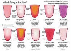 Tongue Autogenic Training, Tongue Health, Running Tips, Traditional Chinese Medicine, Reflexology, Health Info, Chinese Medicine, Acupressure, Natural Medicine