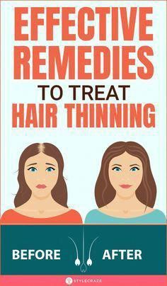 Hair maintenance, hair growth, hair regrowth, losing hair Hair Thickening Remedies, Hair Regrowth Women Remedies, Treat Thinning Hair, Hair Regrowth Women, Thinning Hair Remedies, Thicker Fuller Hair, Hair Massage