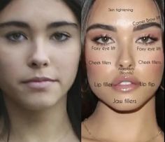 Madison Beer Plastic Surgery, Eyeliner Makeup Looks, Botox Before And After, Lips Inspiration