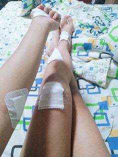 a woman with bandages on her legs laying in bed