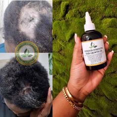 Coffee Hair Growth, Thinning Edges, Natural Hair Care Routine, Black Hair Growth, Coffee Hair, Natural Hair Growth Tips, Grow Long Hair, Oil Hair, Growth Oil