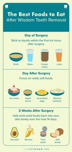 The best foods to eat after wisdom teeth removal are soft, nutritious and don't require a straw or chewing. Here's what to eat and when, according to an expert..
#dentalhealth, #dentalhealthcare Post Wisdom Teeth Food, Wisdom Teeth Recovery Food, Wisdom Teeth Removal Food, Eating After Tooth Extraction, Wisdom Teeth Food, Wisdom Teeth Recovery, Protein Juice, Soft Foods To Eat, After Wisdom Teeth Removal