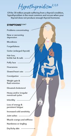 Low Thyroid Remedies, Enlarged Thyroid, Thyroid Remedies, Thyroid Healing, Thyroid Symptoms, Hashimotos Disease, Thyroid Issues, Thyroid Hormone