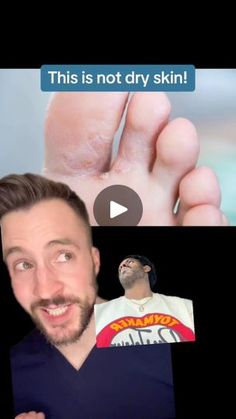 Justin Kelly, Athletes Foot, Health Hacks, Alkaline Diet, Natural Body Care, Foot Care, Online Coaching, Natural Body, Medical School