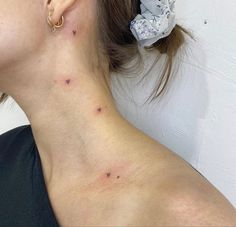 a woman with acne on her neck and behind her ear is a white wall