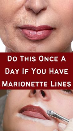 Get rid of wrinkles from your face and lips Makeup Wrinkles, Wrinkles Remedies Face, Mouth Wrinkles, Marionette Lines, Homemade Wrinkle Cream, Wrinkle Free Skin, Lip Wrinkles, Forehead Wrinkles, Skin Care Wrinkles