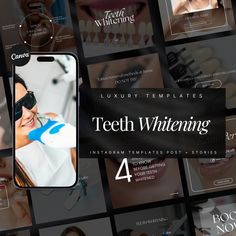 50 Teeth Whitening Instagram Templates | Professional Teeth Whitening Instagram Templates | Teeth Whitening Posts | Teeth Whitening Social Media Post Template What you get: 🦷50 Post Templates 🦷50 Matching Stories Templates 🦷1 PDF with very detailed instructions for how to use canva ( you need an account that is free) DISCLAIMER :  matching stories = same content as the post but every element / text is re-sized to fit the story format  How it Works: 🔥You purchase the template. 🔥 Once Etsy co Story Format, Social Media Post Template, Social Media Templates, Story Template, Post Templates, Instagram Template, Social Media Template, Teeth Whitening, Media Post