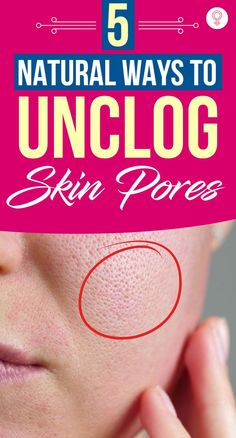 5 Natural Ways To Unclog Skin Pores : For healthy skin, apart from eating right and using the right moisturizer or the right astringent, we also need to be aware of the hazards of harmful chemicals in the skincare products we use as well. So, here are five natural and easy remedies to get rid of various skin pore problems! #beauty #beautytips #skincare #skinpores Open Pores On Face, Getting Rid Of Freckles, Oily Skin Remedy, Lotion For Oily Skin, Face Pores, Moisturizer For Oily Skin, Skin Pores