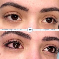 square_cinnamongirlclinic_cosmetictattoos_eyelinertattoo_calgarytattooartist_calgary Bottom Lash Line Eyeliner, Permanent Eyeliner Bottom Only, Lash Line Tattoo, Eyeliner Tattoo Permanent For Hooded Eyes, Lashline Enhancement Tattoo, Ombre Eyeliner Tattoo, Permanent Eyeliner For Hooded Eyes