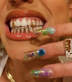 Girls With Grills, Pretty Teeth, Grillz Teeth, Diamond Teeth, Dope Jewelry Accessories, Grills Teeth, Gold Teeth