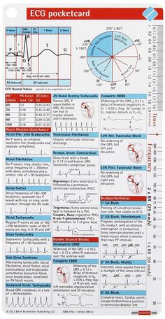 ECG Pocketcard: Bbp: 9781591034896: Amazon.com: Books Nursing Cheat Sheet