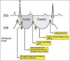 Cardiac Sonography, Cardiology Nursing, Paramedic School, Nursing Mnemonics, Nursing Student Tips, Medical Student Study, Cardiac Nursing, Nursing School Survival, Critical Care Nursing