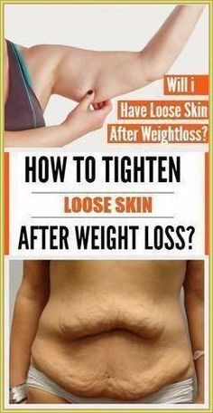 Natural Way To Make Your Saggy Stomach smooth again Tighten Stomach, Skin Firming Lotion, Skin Tightening Stomach, Tighten Loose Skin, Skin Bumps, Saggy Skin, Loose Skin, Lose 50 Pounds, Sagging Skin