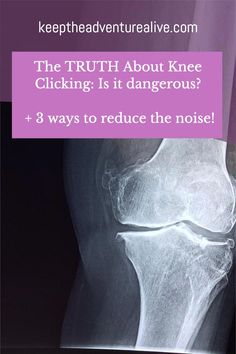 Does your knee clicking make you think something is wrong with your knee? Are you trying to find out what is causing it and how to fix it? Well you are in the How To Stop Cracking Knees, Knee Crackling Sound, Knee Clicking, Cracking Knees, Pain Chart, Core Exercises For Women, Patellofemoral Pain Syndrome, Knee Pain Remedy, Knee Ligaments