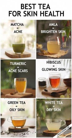 Tea For Skin, Healthy Skin Diet, Books And Tea, Haut Routine, Skin Diet, Types Of Tea, Natural Health Remedies, Healthy Juices