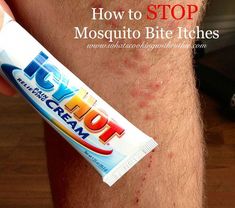 I have the coolest tip to share today- it's such a simple but totally awesome tip that works like a charm! How to STOP Mosquito Bite Itches!! Stop Mosquito Bite Itch