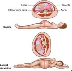 Healthy Sleeping Positions, Sleep On Left Side, Turmeric Lemonade, Thoracic Duct, Benefits Of Sleeping, Mental Health Articles, Lymph Vessels, Learned Helplessness, Gastric Juice