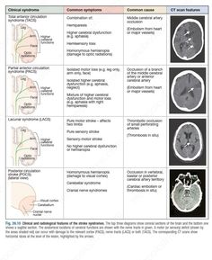 the brain and its functions are shown in this diagram, which shows different areas of the human