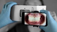 Fotografía dental con móvil (MDP): la nueva era de la fotografía dental #odontología Dental Advertising, Dental Aesthetics, Dental Design, Dental Art, Funny Education Quotes, Electronic Products, Photography