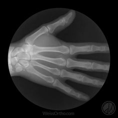 a hand is shown in the middle of a black and white photo, as if it were an x - ray