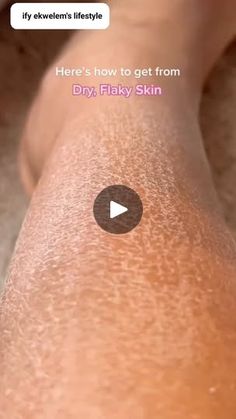 75K views · 884 reactions | If you have dry flaky skin, stubborn dark spots and scars on your skin, make this cinamon oil and see it clear it in one week #followers #everyone... | By Ify Ekwelem's lifestyle | So if you have dry flaky skin,
this cinnamon oil made at home transform that skin from what
you saw to this within days. Now let's go on how to make
this oil. So you are going to get yourself olive oil. You are
going to get cinnamon stick. So you need like six to seven
cinnamon stick, put it in a clean jar, bottle jar and then
pour in your oil in it. And after it you are going to add
your juju par oil to it. I always add my olive oil and
when it's almost full to the brain, I use jojoba oil to fill
it up then you are going to cover it up and then put water
on fire and when the water st Dry Flaky Skin, Cinnamon Oil, Flaky Skin, Night Routine, My Skin, One Week, Bring It, Jojoba Oil, The Brain