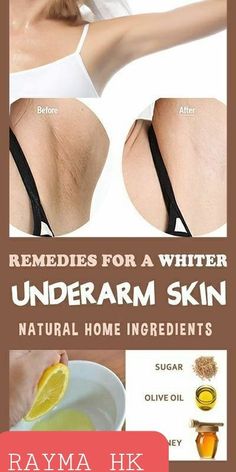 Rid Of Dark Underarms, Haut Routine, Natural Skin Care Remedies, Dark Underarms, Brown Spots On Face, Perfect Skin Care Routine, Healthy Skin Tips