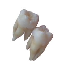 two tooth models are shown against a white background