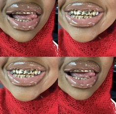 Gold Teeth Grills, Dental Jewelry, Gold Grill, Grills Teeth, Tooth Gem