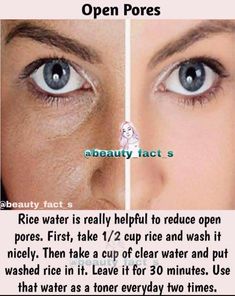 Clear Skin Face, Skin Face Mask, Open Pores, Natural Skin Care Remedies, Good Skin Tips, Rice Water, Beauty Tips For Glowing Skin