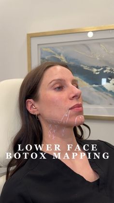 Riley Worth Henrichsen APRN, MSN, FNP-C, FNP-BC | Lower face Botox mapping! The lower face does age too!! Depressor Anguli oris muscle (DAO)- pulls down the corners of your mouth... | Instagram Botox Placement, Botox Mapping, Platysmal Bands, Filler Aesthetic, Nurse Injector, Botox Fillers