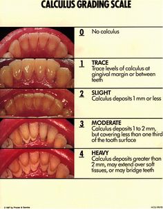 Dental Education, Dental Assisting