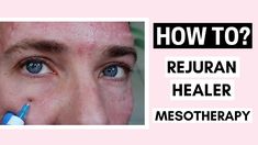 Rejuran Healer Skin Booster Mesotherapy Before And After Ft. @Vanidiy