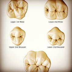 Dental Drawings, Dentist Funny, Dental Ceramics, Hygiene School, Dental Assistant Study, Dental Hygiene Student, Dental Images, Dental World