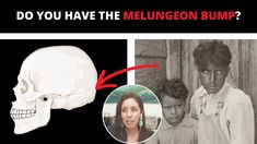 an image of a man and woman next to a skull with the caption do you have the melugon bump?