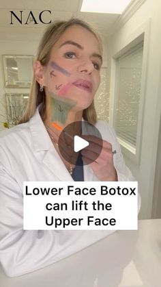 Botox Locations On Face, Platysmal Band Botox Before And After, Botox Face Lift, Botox And Filler