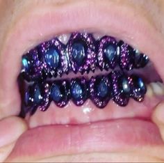 Grillz Teeth, Men's Watch Accessories, Diamond Teeth, Skateboard Art Design, Dope Jewelry Accessories, Blackout Tattoo, Grills Teeth, Tooth Gem, Gold Teeth