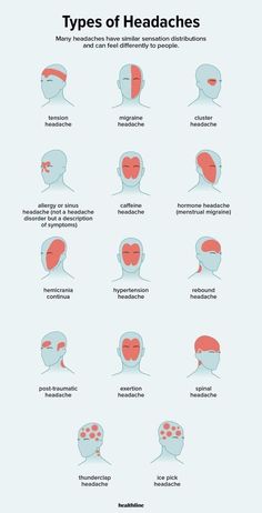 Throbbing Headache, Medical Knowledge, Health And Beauty Tips, Health Facts, Health Info, Home Health, Useful Life Hacks