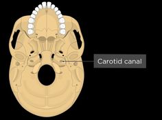 Carotid canal~[temporal bone] internal carotid artery, internal carotid nerve plexus. Nerve Plexus, Temporal Bone, Internal Carotid Artery, Maxillofacial Surgery, Carotid Artery, Weight Plates, Nerve, Plexus Products, Surgery