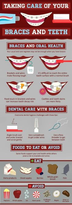 Taking Care of Your Braces and Teeth Braces Food, Braces Tips, Getting Braces, Braces Colors, Dental Braces, Teeth Braces, Teeth Care, Dental Hygiene